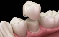 Ортопедия в стоматологии