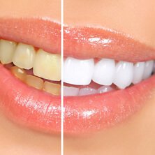 Необходима коррекция контуров и положения зубов
